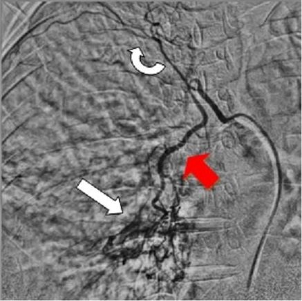 Chest/Lungs Interventions